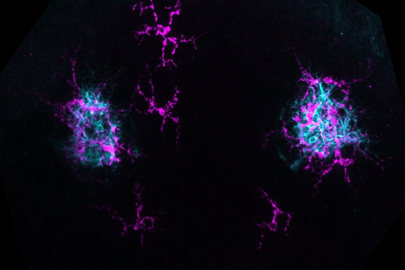 Two circular regions of cyan and magenta, with spidery clusters of magenta between and near them